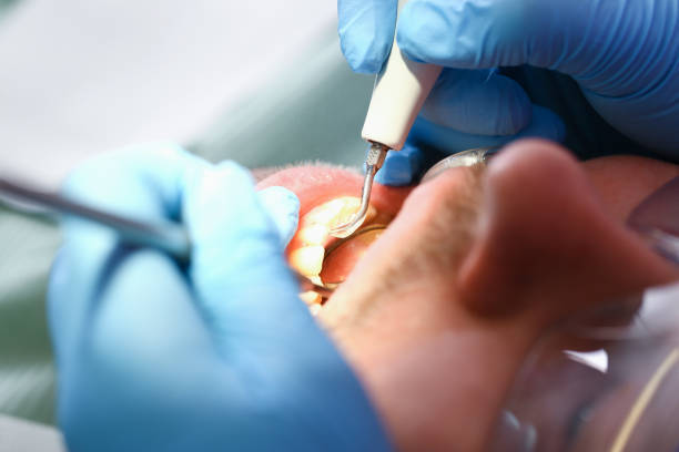 Best Pediatric Emergency Dentist in Baywood, NY